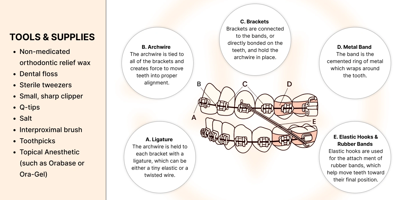 img-parts-of-braces
